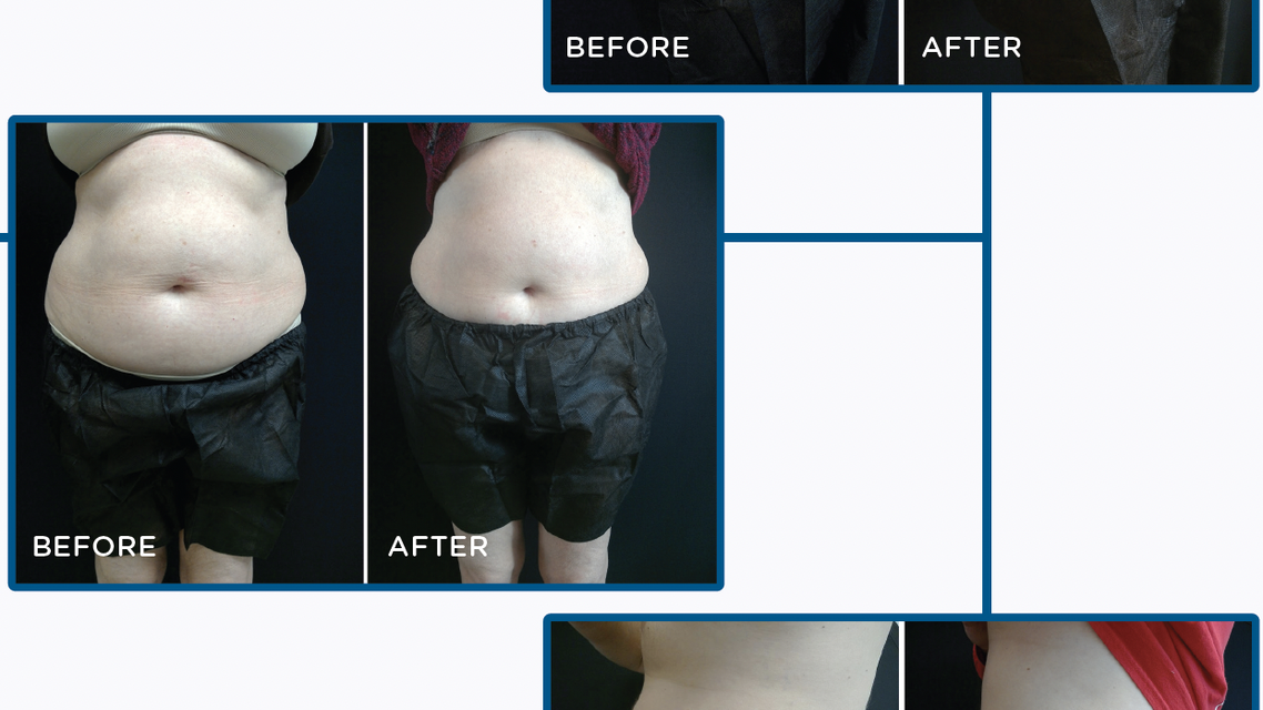 1221_BTL_Fig8.png