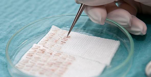 Turn Key Hair Restoration Requires Caution The Specialists Perspective