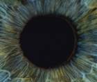 Permanent Iris Color Change