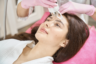 RF Microneedling