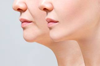 facial rejuvenation