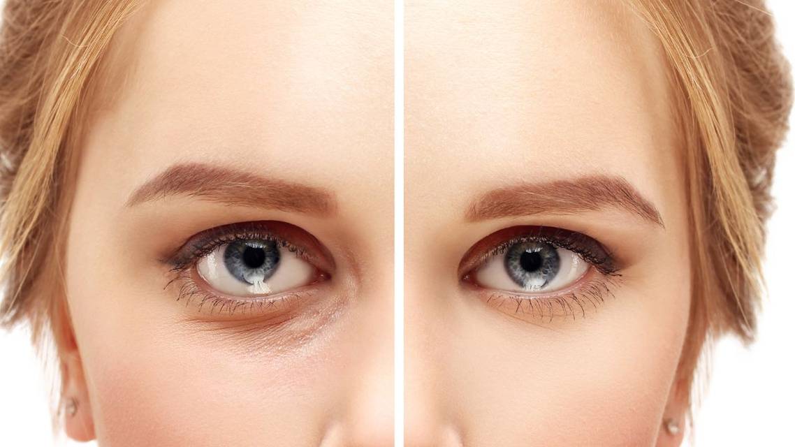 A Modern Approach to Facial Aging