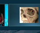 Avoiding Ocular Complications in Aesthetics thumbnail