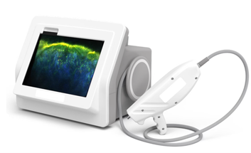 Enspectra Healths VIO handheld cross modal imaging system