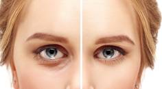 A Modern Approach to Facial Aging