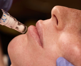SkinPen