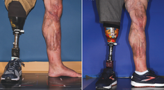 modern aesthetics Beachkofsky