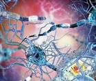 Using Nerve Blocks to Avoid Pain and Narcotics for Rhinoplasty