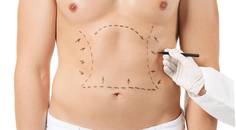 liposculpting