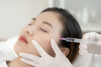 Hyaluronic acid filler