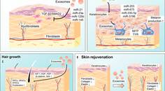 Exosomes