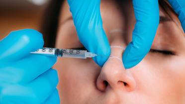 dermal fillers stock nose