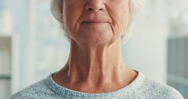 Neck wrinkles iStock