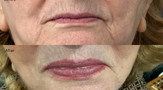 modern aesthetics moradzadeh