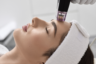 RF Microneedling