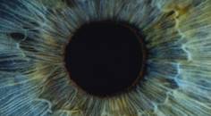 Permanent Iris Color Change