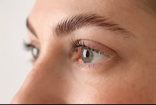Brow Lift