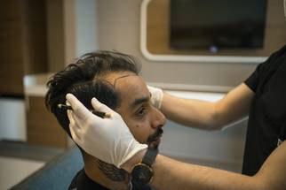 hair transplantation via iStock
